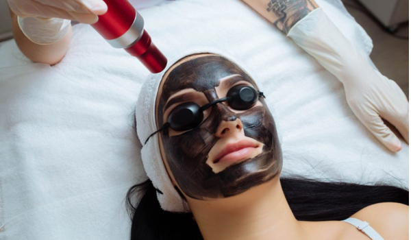 Laser Carbon Peel