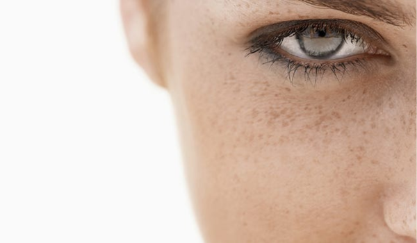 Pigmentation & Uneven Skin Tone