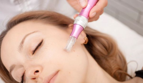 Microneedling Treatment By Dr. Chahal