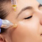 PRP for Skin Rejuvenation Treatment by Dr. Chahal