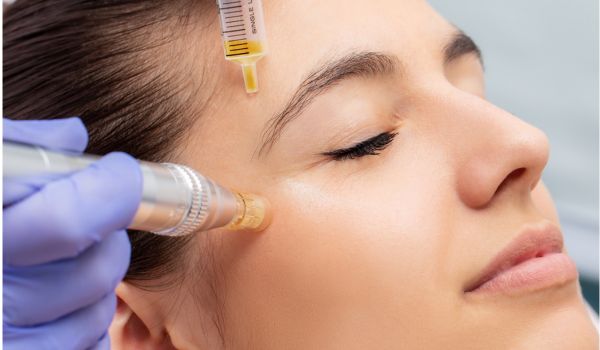 PRP for Skin Rejuvenation Treatment by Dr. Chahal